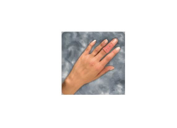 MALLETFİNGER PARMAK ATELİ